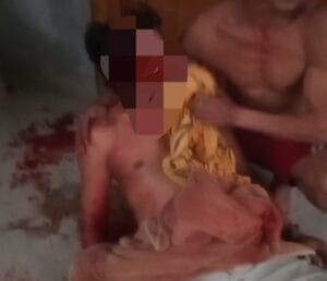 Petani Sambangrejo Modo Lamongan Dianiaya Oknum ASN Hingga Berlumuran Darah