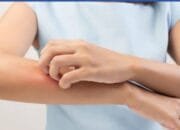 Cegah Penyakit Kusta, Ini Gejala dan Pengobatannya