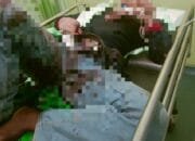 Petugas Perhutani di Tuban Mendapat Perawatan Medis Akibat Sabetan Sajam