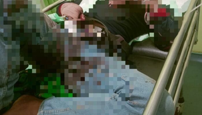 Petugas Perhutani di Tuban Mendapat Perawatan Medis Akibat Sabetan Sajam