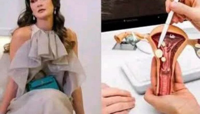 Luna Maya Bekukan Sel Telur di Umur 38 Tahun