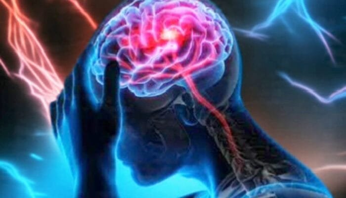 Rahasia Otak Tetap Cerdas di Usia Tua, Dokter Saraf Bojonegoro Beberkan Tipsnya